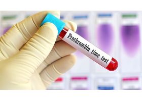 1xetnghiemprothrombinptlagitaisaocanlamxetnghiemptafd6aea071-7294.jpg