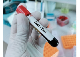 adh-test-9441.png