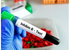 bloodsampleinhibinbtest5954402768-4203.jpg