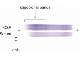oligoband-9251.png